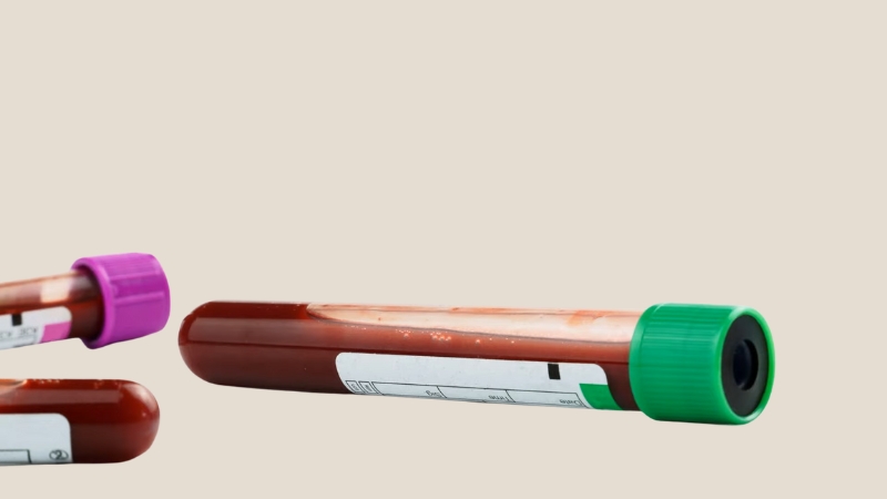 Epruvete sa uzorcima krvi položene na svetloj podlozi