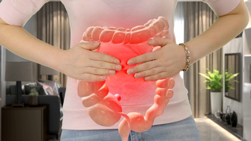 Sindrom iritabilnog creva – kako razlikovati od obične nadutosti