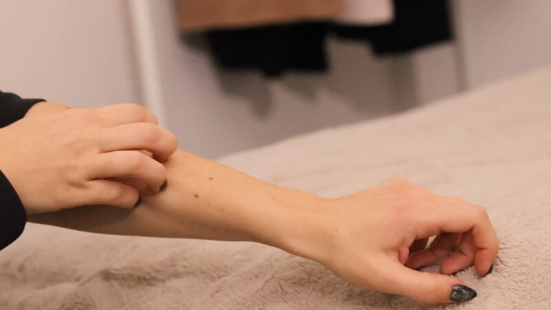 devojka se češe po ruci