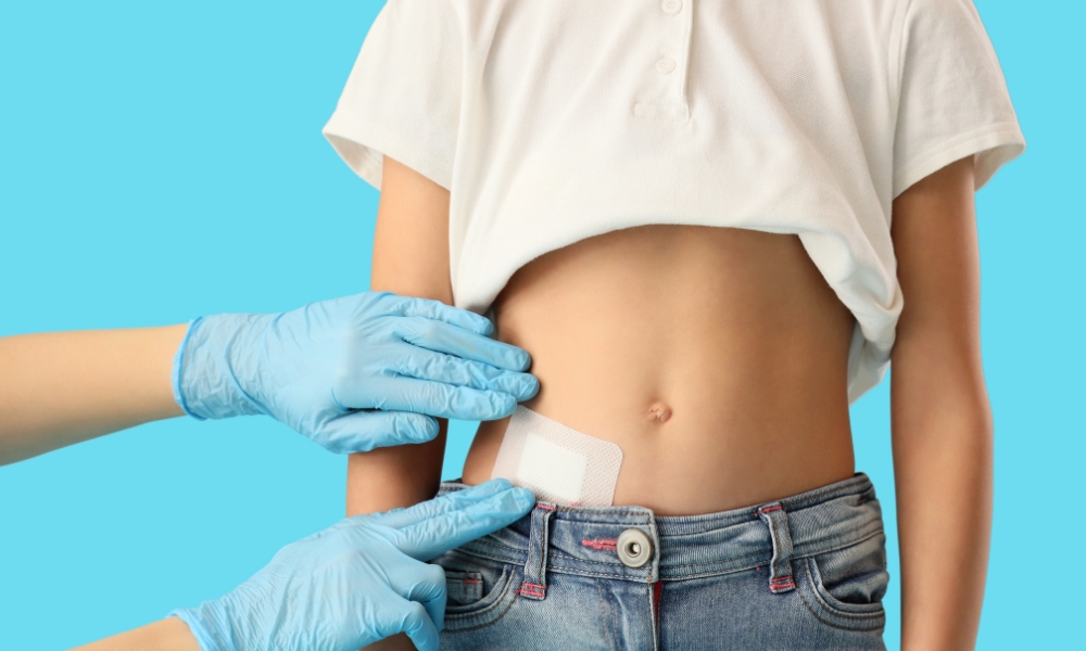 Oporavak nakon operacije slepog creva najčešće traje nekoliko nedelja i uključuje postepeni povratak svakodnevnim aktivnostima