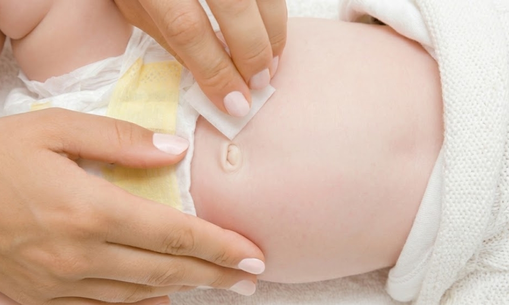 pupčana kila kod beba