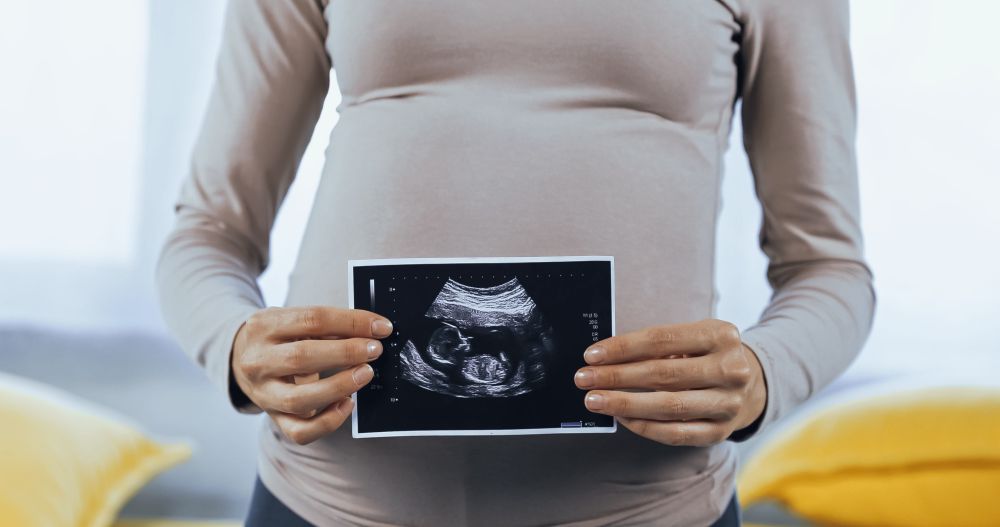 Trudnica drži ultrazvučni snimak bebe ispred stomaka